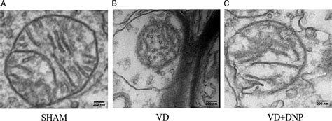 Dendrobium Nobile Polysaccharides Attenuates Ferroptosis and Improves Cognitive Function in ...