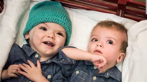 Separated twins move to rehab after emotional farewell - CNN