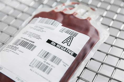 A negative blood type facts - towerluli