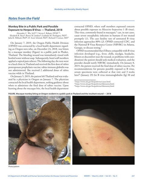 (PDF) Notes from the Field: Monkey Bite in a Public Park and Possible ...