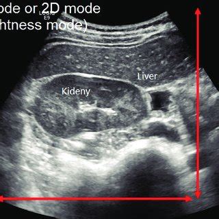 Ultrasound basic physics | Download Scientific Diagram