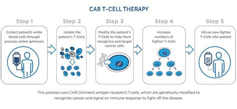 CAR T-Cell Therapy | Colorado Blood Cancer Institute