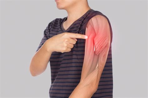 Dechirure musculaire : comment la reconnaître ? - https://www.footsteal.com