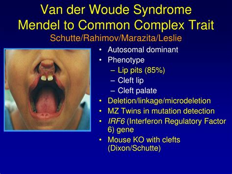 PPT - Comprehensive genetic approaches to cleft lip/palate PowerPoint Presentation - ID:9576672