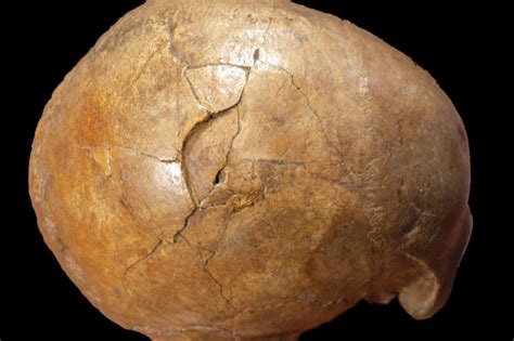 Study concludes 33,000-year-old skull shows signs of blunt-force trauma - Ars Technica