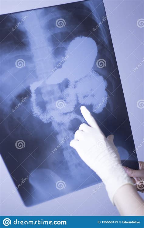 Medical Xray Spine Hip Scan Stock Image - Image of internal, health: 135550479