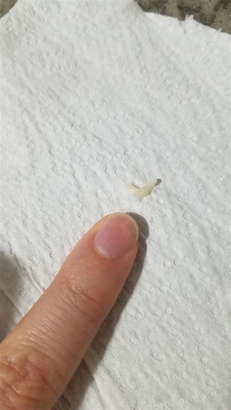 Found this on my cat, it moves around kind of like a worm and is tiny. Please help me identify ...