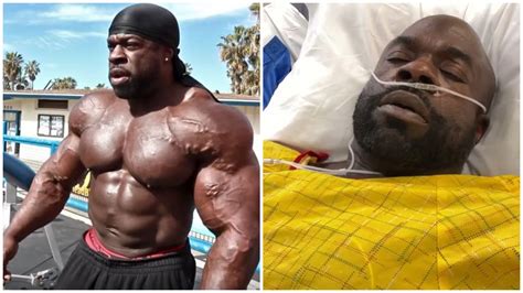 Bodybuilder Kali Muscle suffers heart attack, admitted to hospital