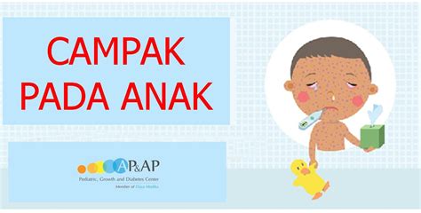 CAMPAK PADA ANAK – Klinik Anak AP&AP Jakarta