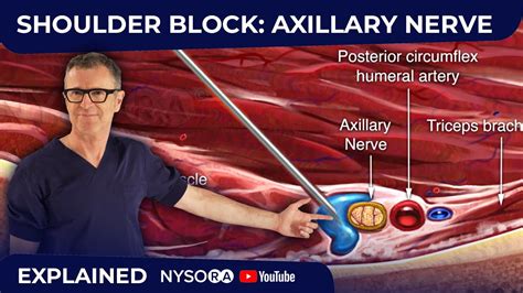 Axillary Nerve Block