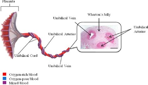 [PDF] Umbilical Cord Blood Hematopoietic Stem Cell Transplantation, an ...