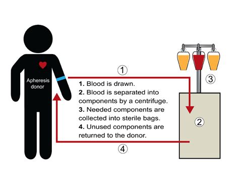 Apheresis explanation in simple terms. Courtesy: Lifesouth.org | Blood donation, Medical advice ...