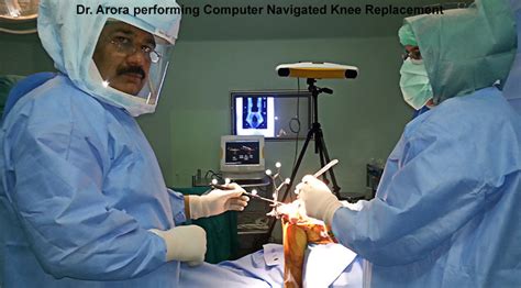 Computer Assisted Knee Replacement - Dr. (Prof.) Anil Arora