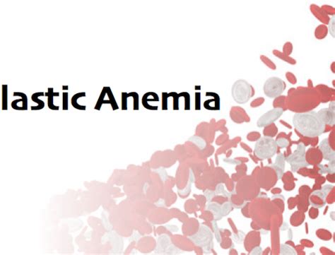 Aplastic Anemia Diagnosis and Treatment in Thailand Archives - Almurshidi Medical Tourism Agency ...