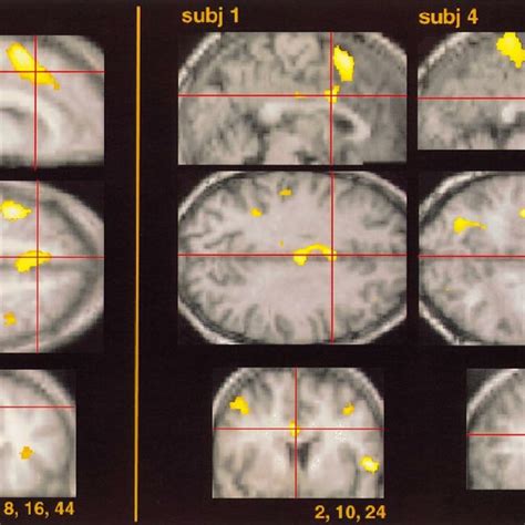 Locations of frontal eye fields reported in this and previous studies ...