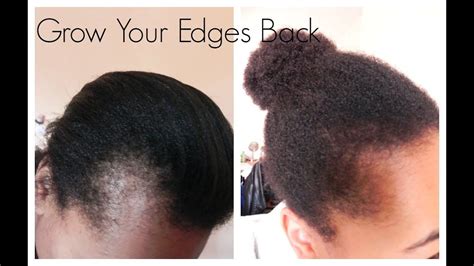 How To Grow Edges Back After Braids