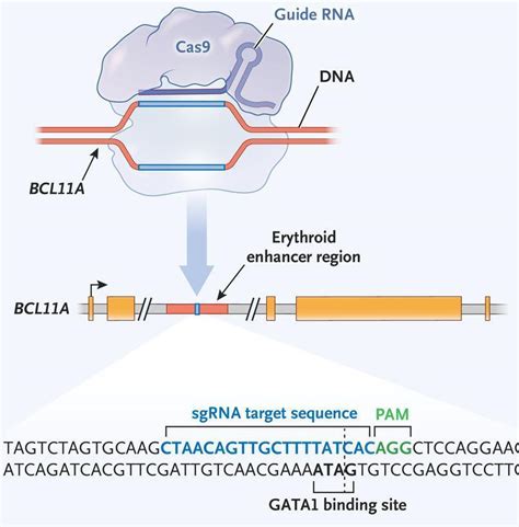 Gene editing as a potential sickle cell disease immunotherapy ...