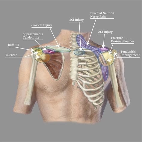 Shoulder Pain Symptom Checker & Pain Diagnosis Chart [Injury Self-Diagnosis Tools]