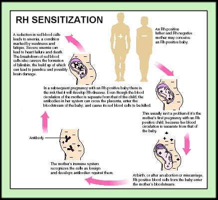 Rh Sensitization | Good Eats!! | Midwife training, Student midwife, Pregnancy