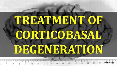 TREATMENT OF CORTICOBASAL DEGENERATION - YouTube