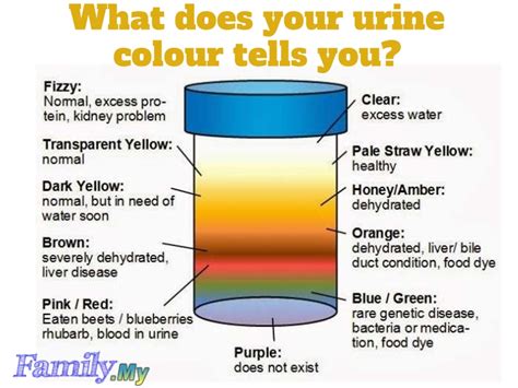 What does your urine colour tells you? - Malaysia Health Family medicine and Healthcare