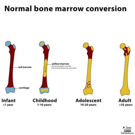 Marrow conversion throughout development occurs in a predictable ...