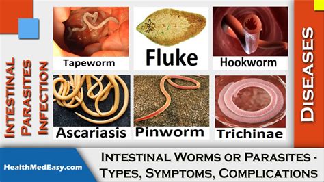 Worms (Intestinal) - Symptoms, Types, Complications - HealthMedEasy.com ...