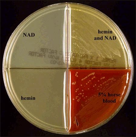 Gram-Negative Coccobacilli - Microbiology learning: The "why"ology of microbial testing