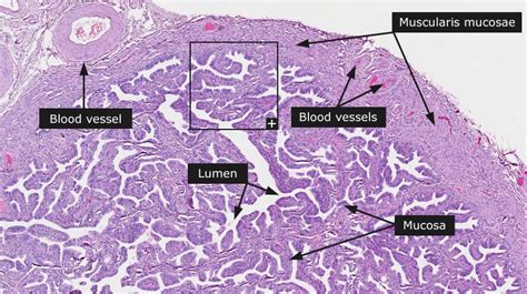 Dictionary - Normal: Fallopian tube - The Human Protein Atlas ...