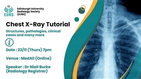 Chest X-Ray Tutorial | Event listing | MedAll