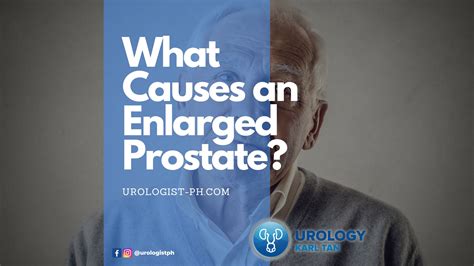 What Causes An Enlarged Prostate? | Karl Marvin M. Tan, MD, MMHoA, FPUA