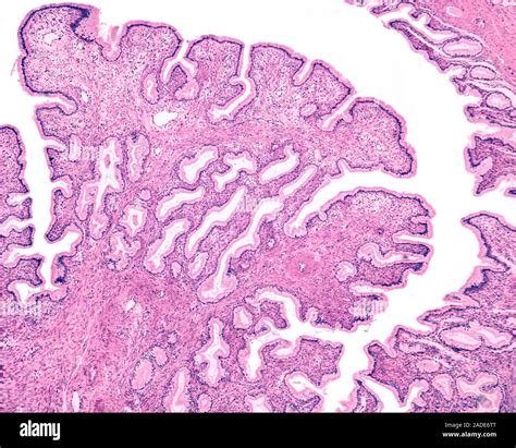 Low magnification light micrograph of the endocervical mucosa. The ...