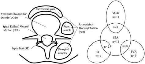 Schematic of the four PSI types and location (left) and Venn diagram... | Download Scientific ...