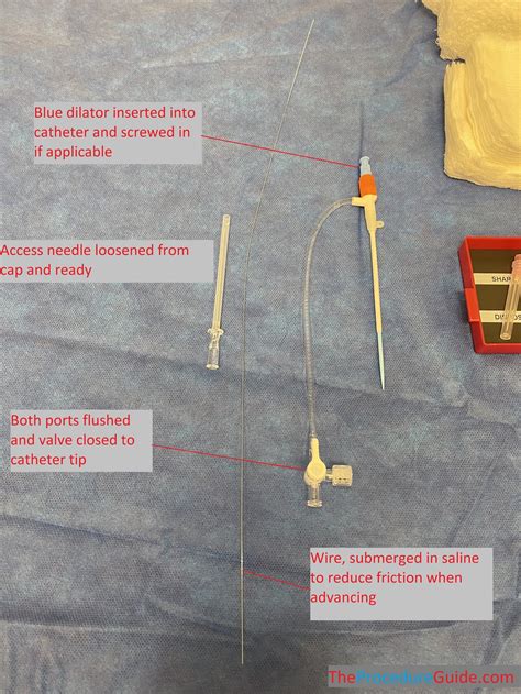 Ultrasound Guided Seldinger Venous Access – Technique and Overview ...