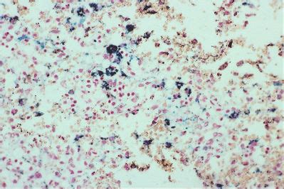 Cells and Fibers - Hemosiderin - histology slide