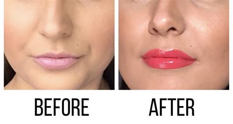 Before and after hottie lip plumper | Lip plumper, Lips, Queen bees