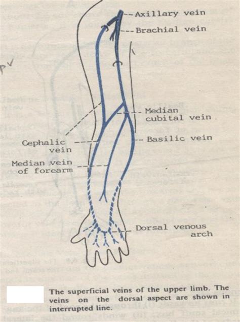 cephalic vein thrombosis - ModernHeal.com