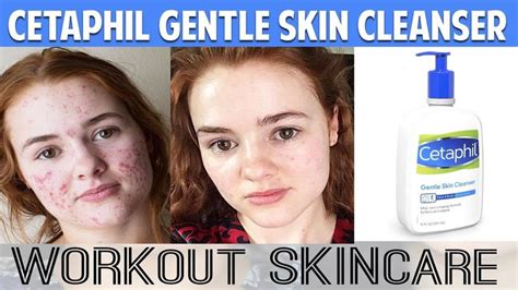 Cetaphil Gentle Skin Cleanser | 20 fl oz Hydrating Face Wash Sensitive, ... | Skin cleanser ...