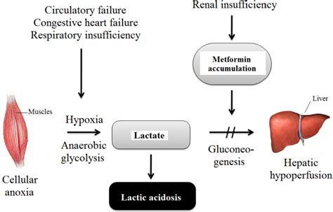 Metformin induced lactic acidosis--particularities and course ...