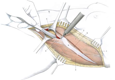 3 Thoracolumbar Junction | Musculoskeletal Key