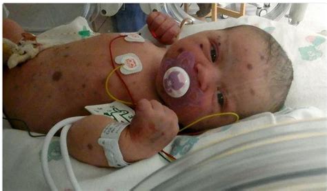 Ever Seen A Baby Born With BLUE SPOTS? If You Do, Here’s What it Means – And It Is Scary ...