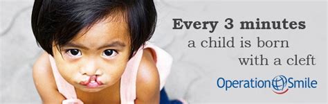 Operation Smile- changes children’s lives one smile at a time