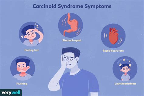 Carcinoid Syndrome: Symptoms, Causes, Diagnosis, and Treatment