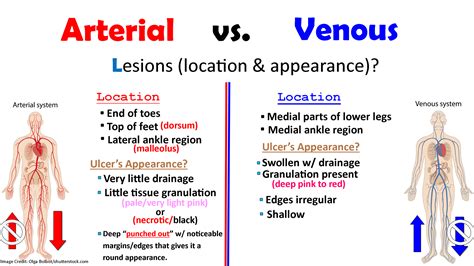 Arterial And Venous Ulcers