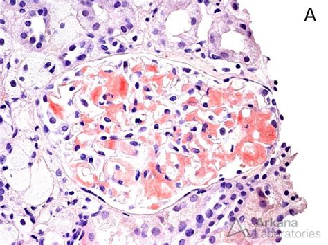 Congo Red Stain Tutorial | Teaching Points | Arkana Laboratories