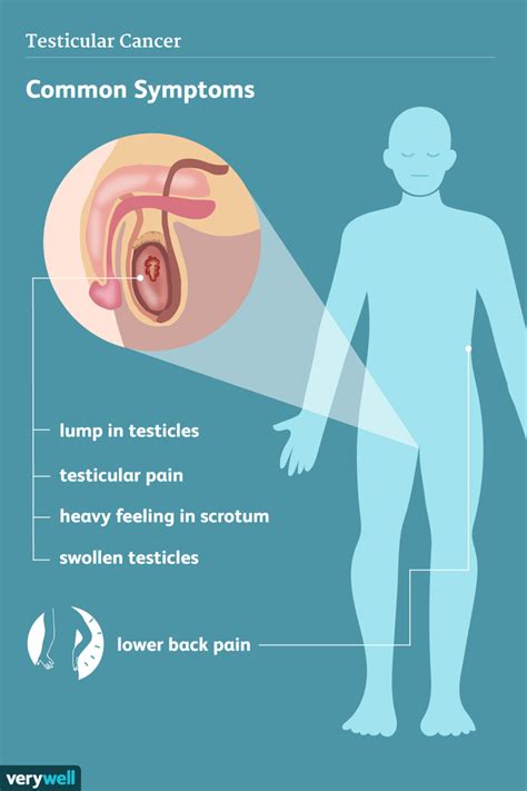 Signs, Symptoms, and Complications of Testicular Cancer