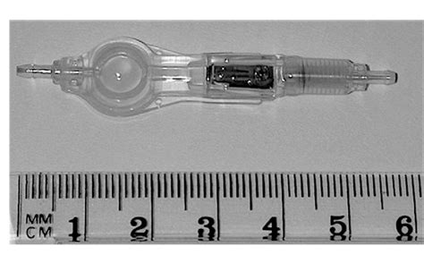 [PDF] Magnetically programmable shunt valve: MRI at 3-Tesla. | Semantic ...