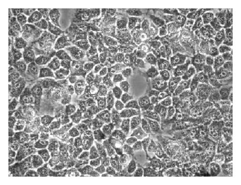 Effect of MRE exposure on HepG2 cell morphology. HepG2 cells were ...