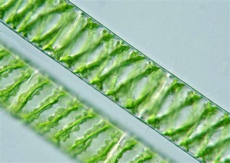 Protist Images: Spirogyra