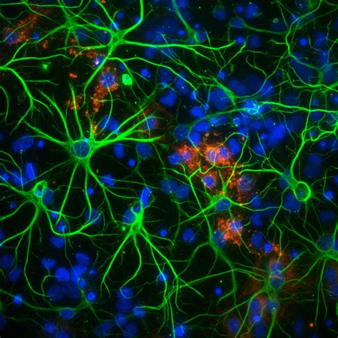 ImageXpress Confocal, Confocal Imaging, Spinning Disc Confocal ...